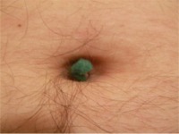 Navel_lint_ball.jpg